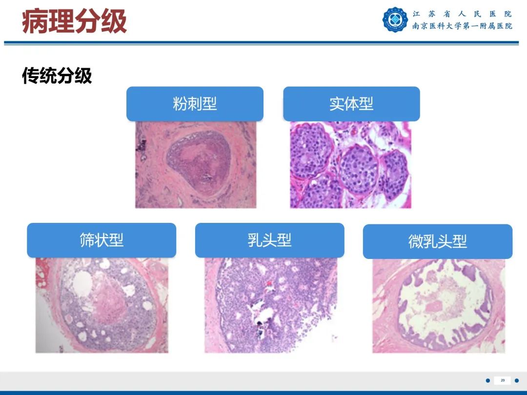 【PPT】导管原位癌-30