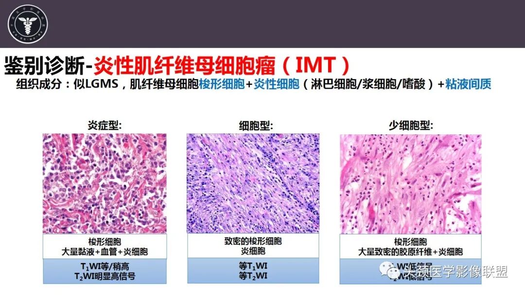 【病例】咬肌间隙肌纤维母细胞肉瘤1例MR诊断与鉴别-22
