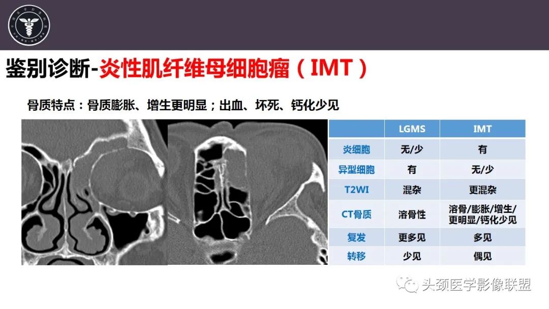 【病例】咬肌间隙肌纤维母细胞肉瘤1例MR诊断与鉴别-25
