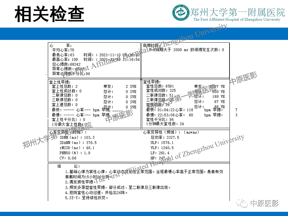 【病例】致心律失常性右室心肌病1例MR影像-3