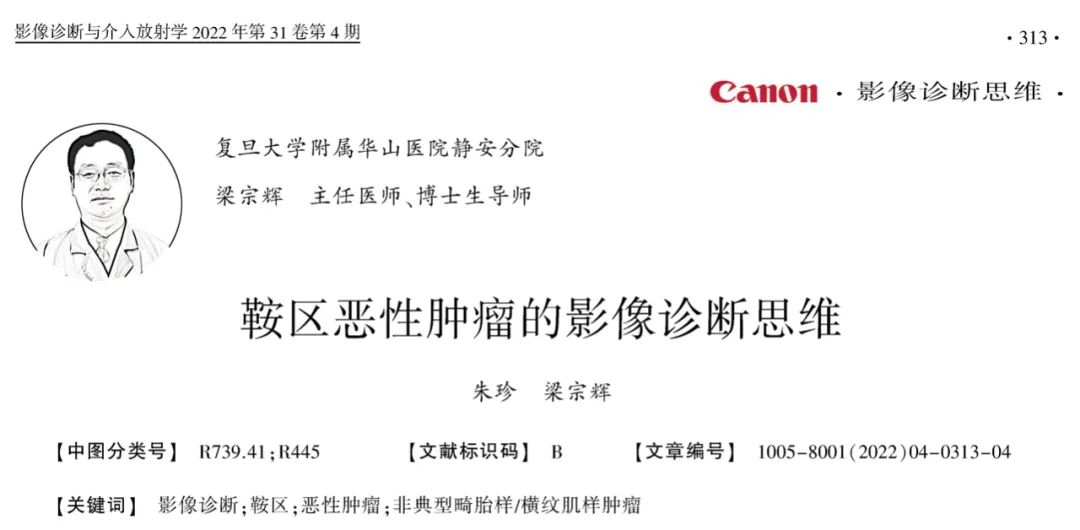 【病例】鞍区恶性肿瘤—非典型畸胎样/横纹肌样肿瘤1例CT及MR影像诊断思维-1