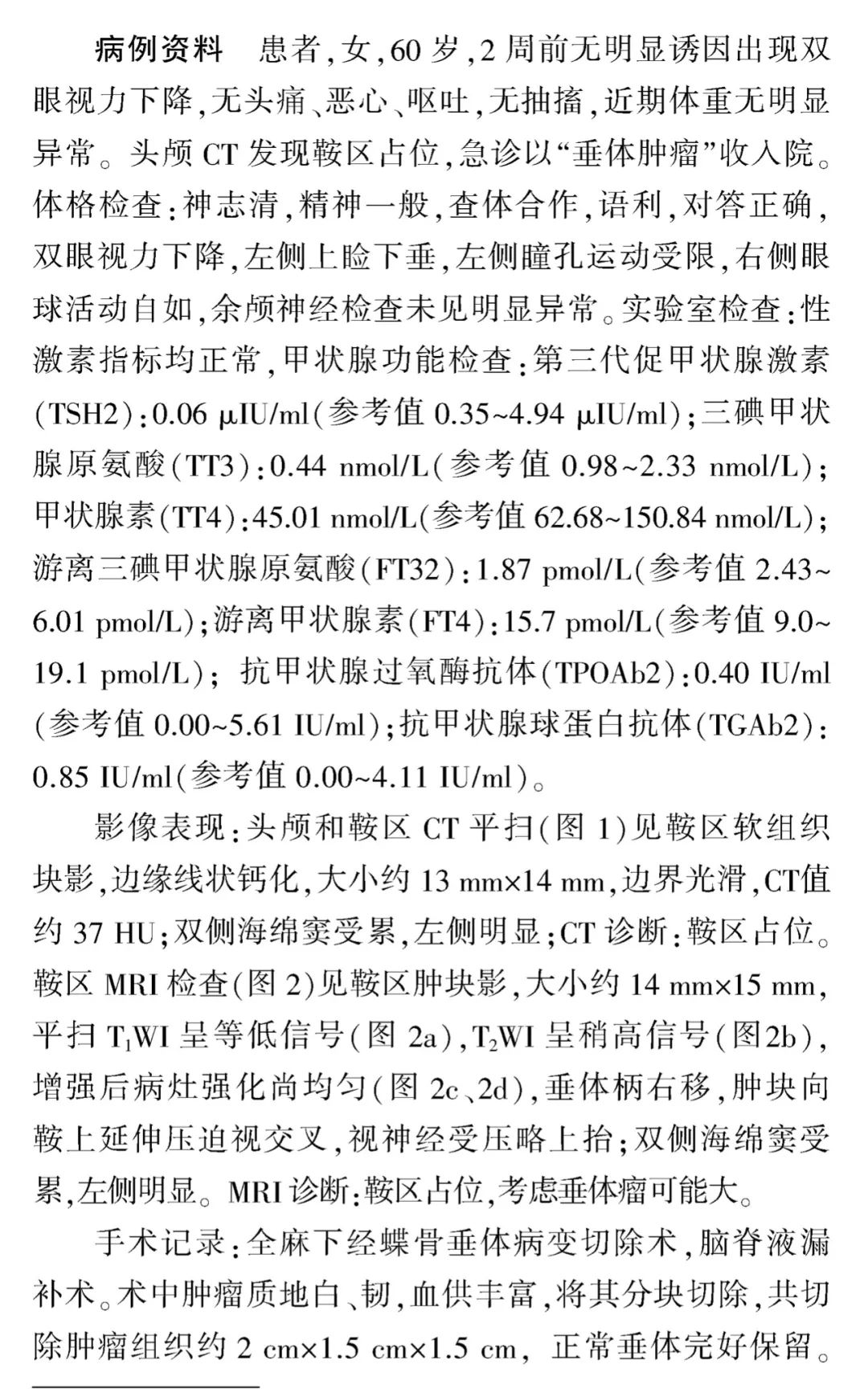 【病例】鞍区恶性肿瘤—非典型畸胎样/横纹肌样肿瘤1例CT及MR影像诊断思维-3
