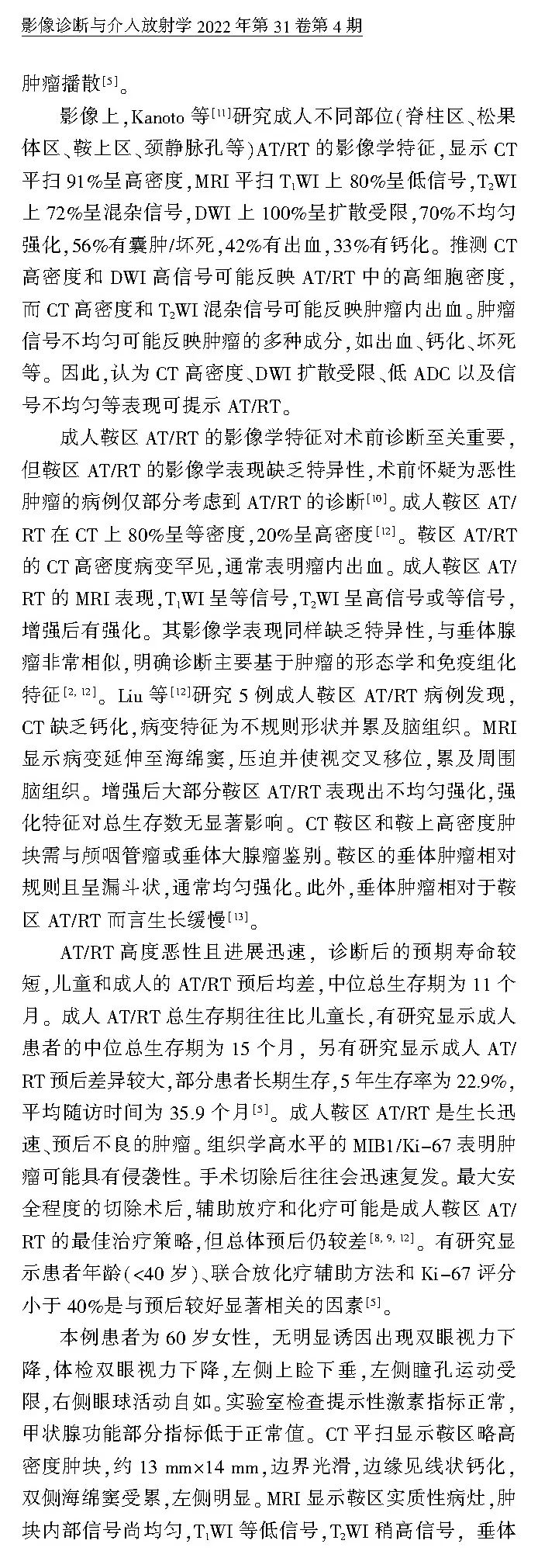 【病例】鞍区恶性肿瘤—非典型畸胎样/横纹肌样肿瘤1例CT及MR影像诊断思维-8
