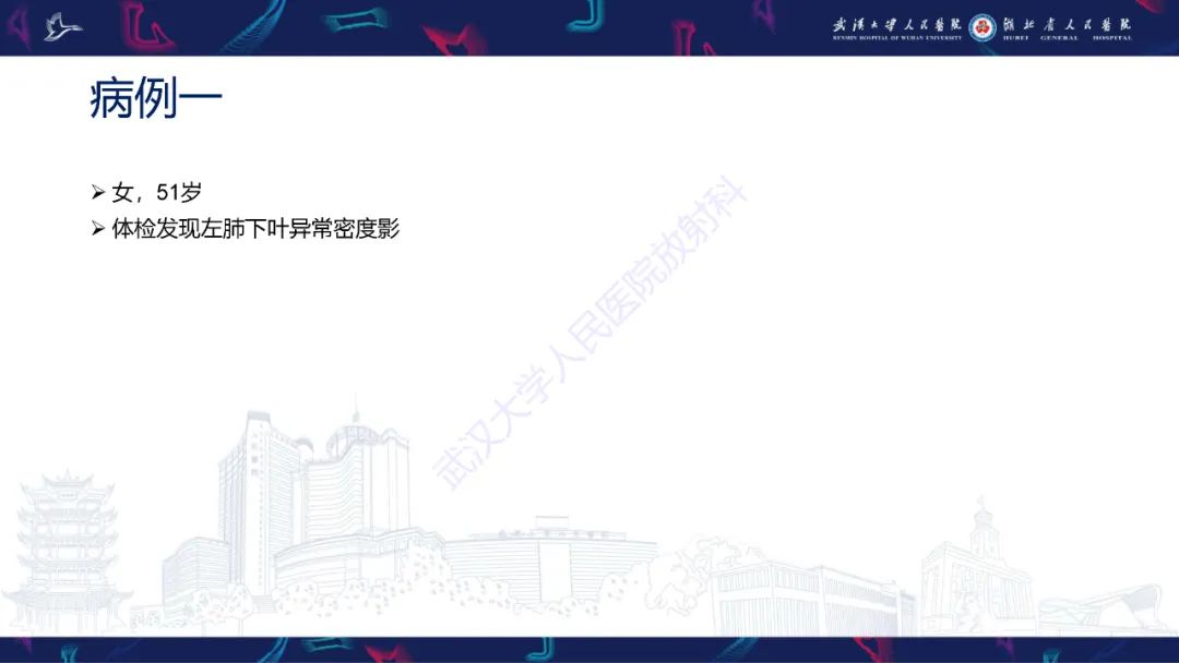 【PPT】肺动静脉畸形CT诊断-2