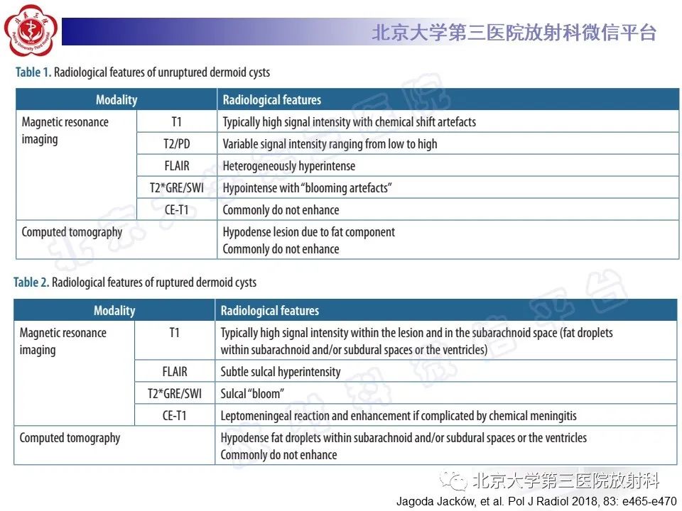 【PPT】颅内皮样囊肿-21