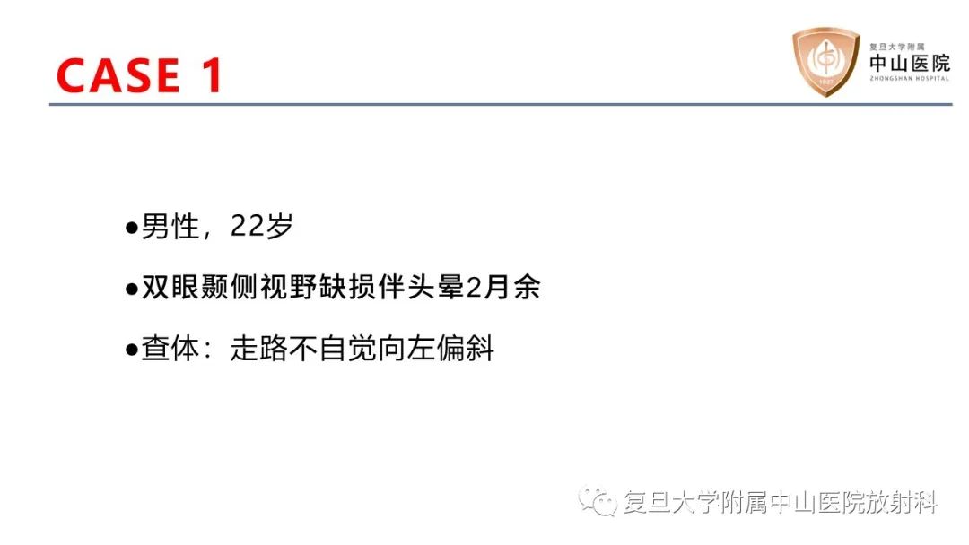 【病例】颅咽管瘤2例CT及MR影像-2