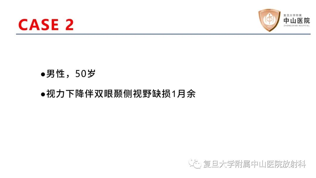 【病例】颅咽管瘤2例CT及MR影像-6