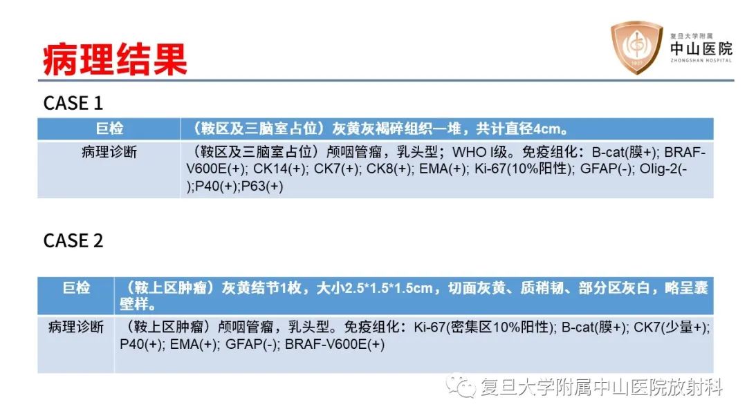 【病例】颅咽管瘤2例CT及MR影像-9