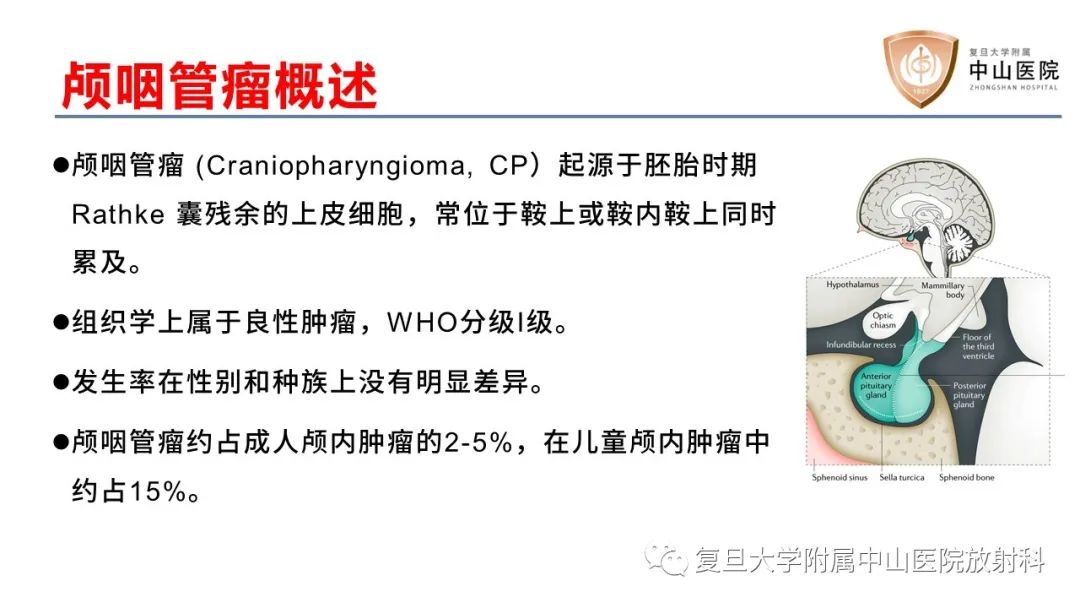 【病例】颅咽管瘤2例CT及MR影像-10