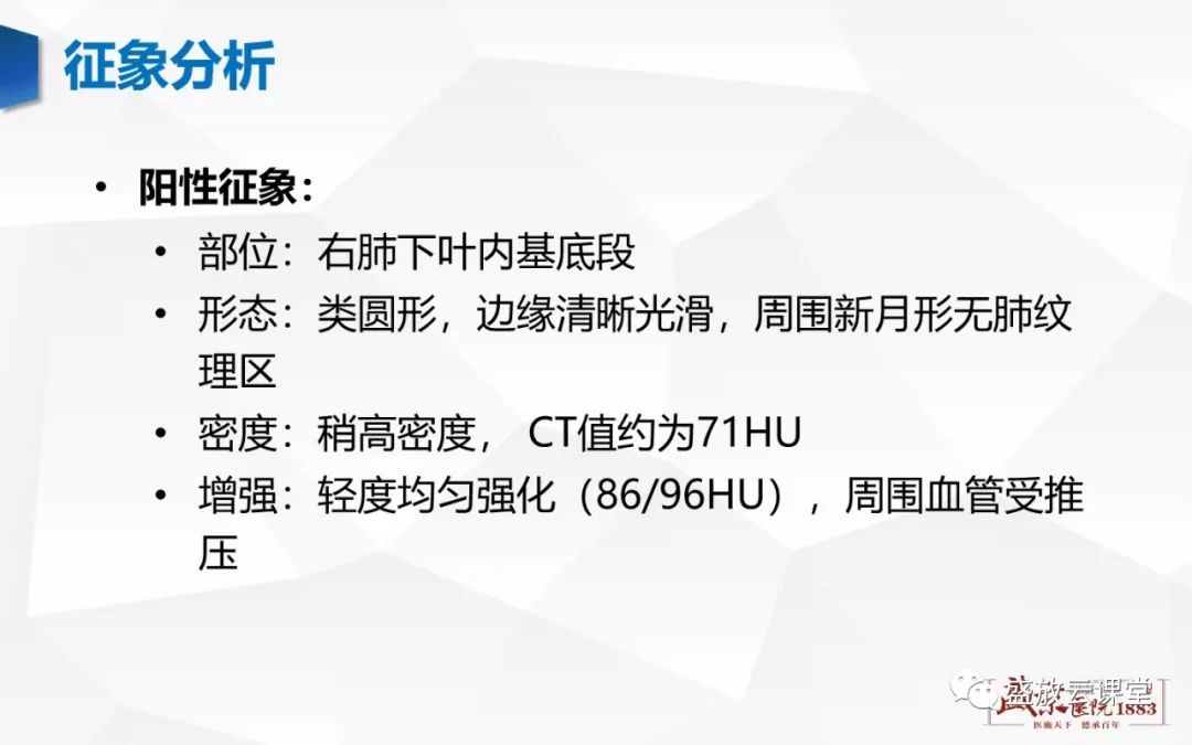 【病例】硬化性肺细胞瘤1例CT影像-5