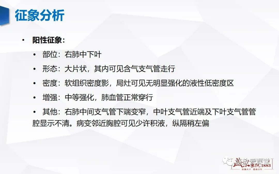 【病例】肺淋巴瘤(MALT)一例CT影像-4