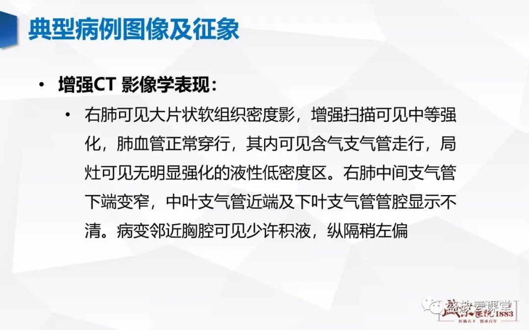 【病例】肺淋巴瘤(MALT)一例CT影像-3