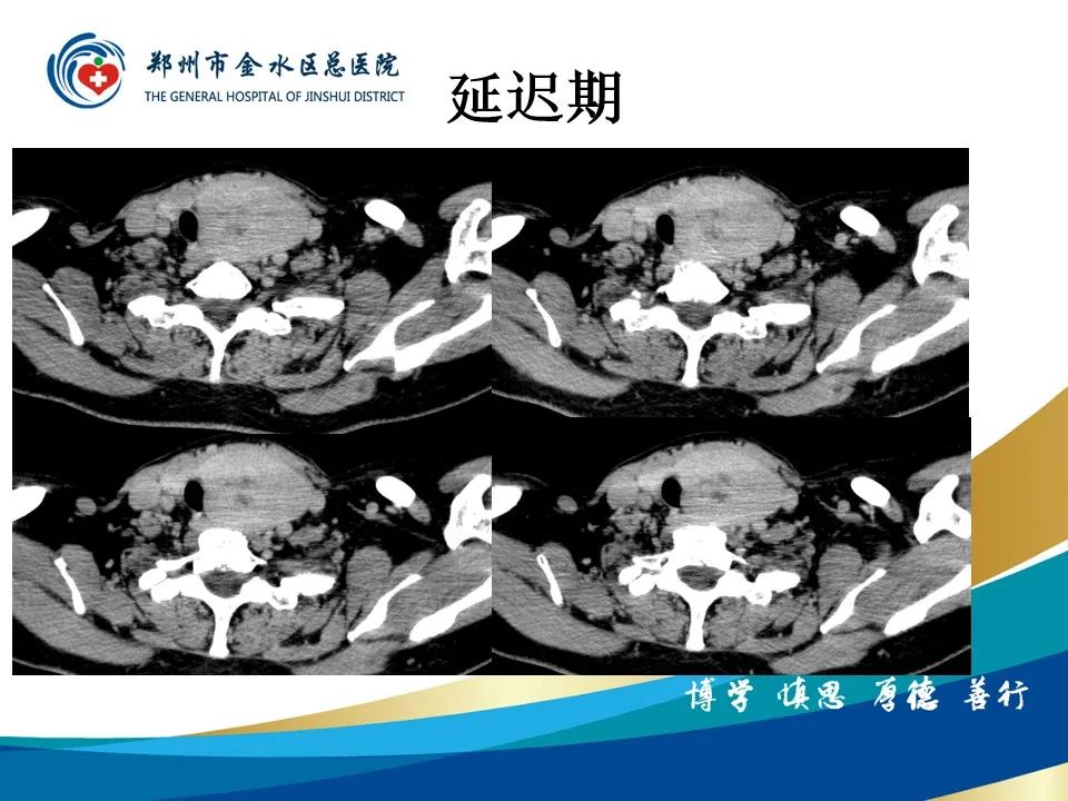 【PPT】甲状腺常见相关疾病的影像诊断-12