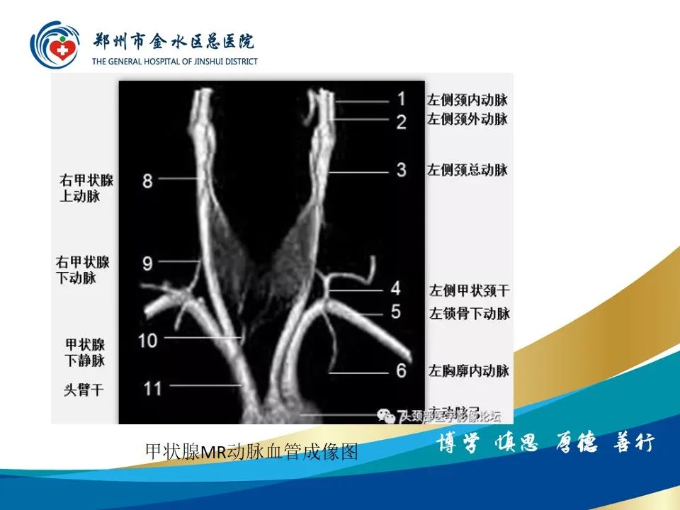 【PPT】甲状腺常见相关疾病的影像诊断-19