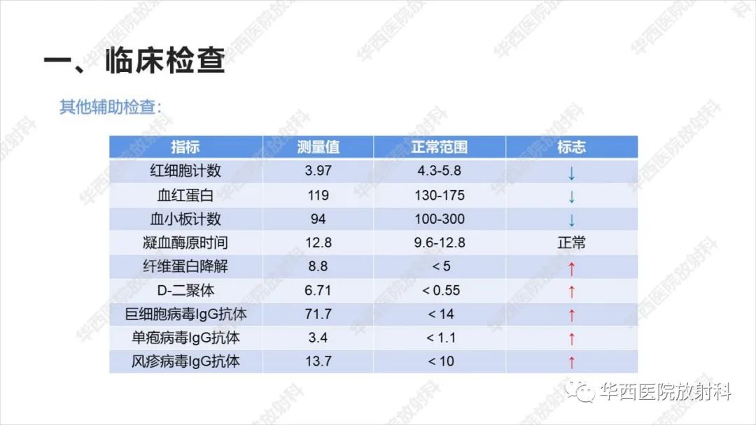 【病例】出血坏死性病毒脑膜脑炎1例CT及MR影像学表现和鉴别诊断-3
