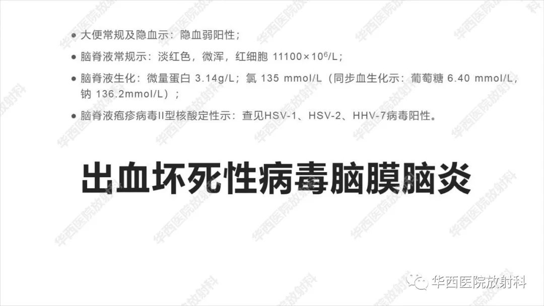 【病例】出血坏死性病毒脑膜脑炎1例CT及MR影像学表现和鉴别诊断-15