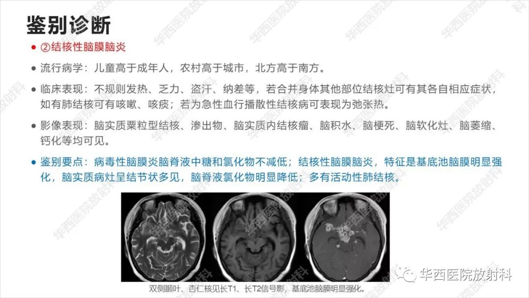 【病例】出血坏死性病毒脑膜脑炎1例CT及MR影像学表现和鉴别诊断-23