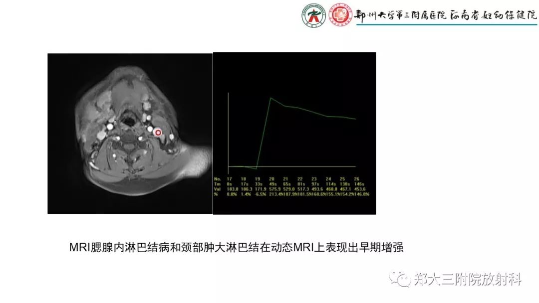 【PPT】木村病(kimura disease)临床特征及MR表现-11