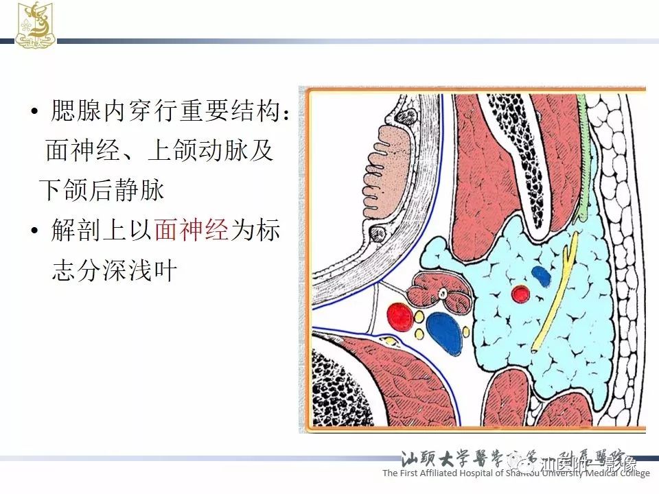 【PPT】腮腺病变CT诊断-3