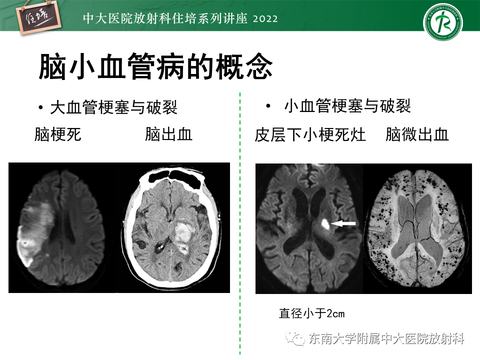 【PPT】脑小血管病概念、影像维度及其深度学习进展-4