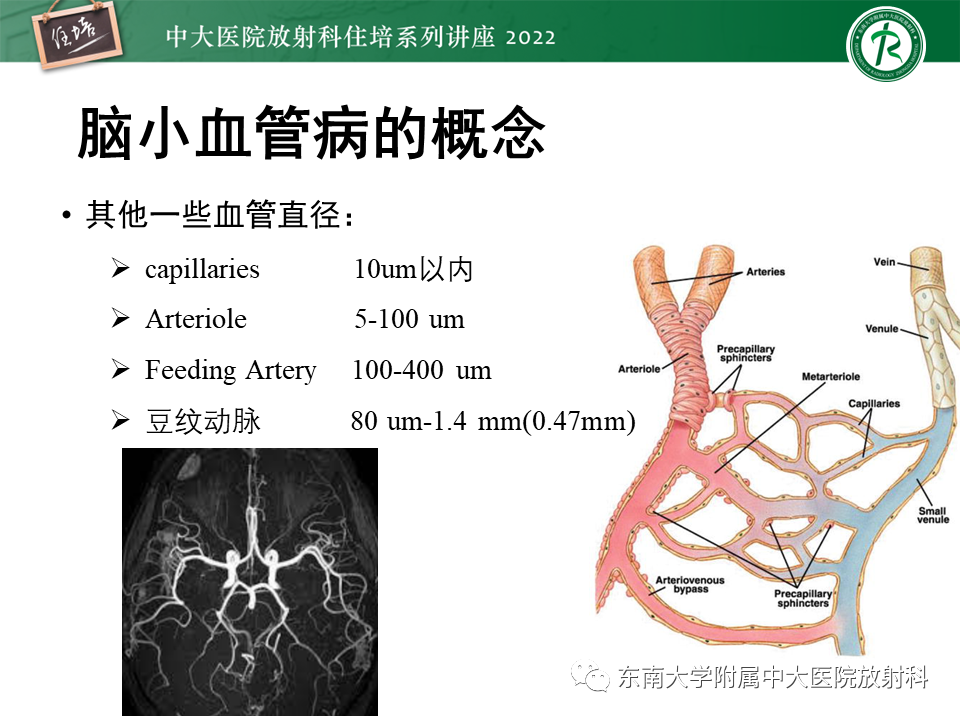 【PPT】脑小血管病概念、影像维度及其深度学习进展-3