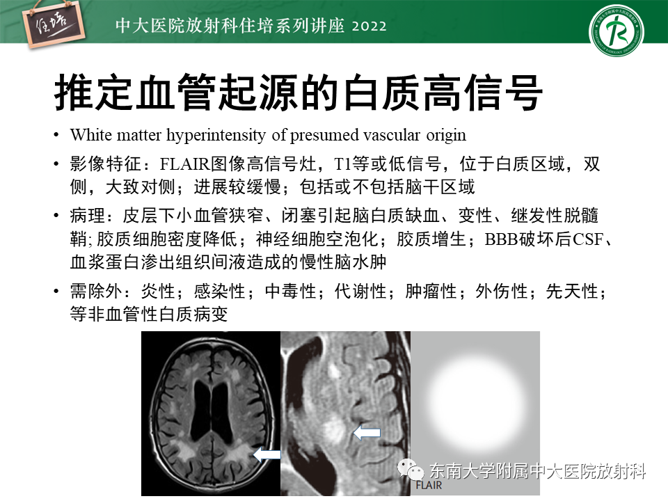 【PPT】脑小血管病概念、影像维度及其深度学习进展-8