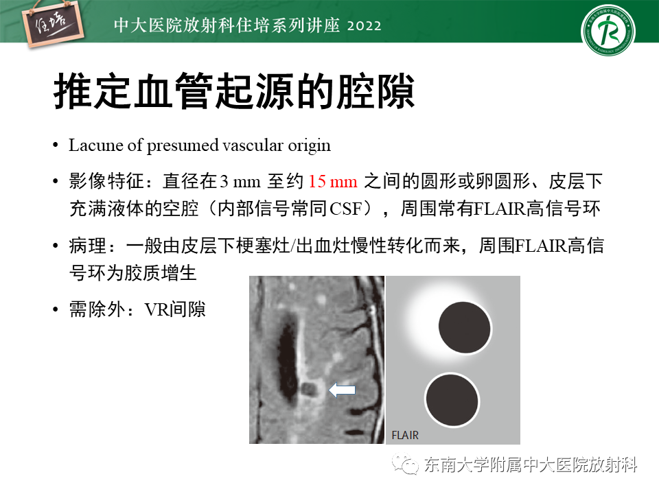 【PPT】脑小血管病概念、影像维度及其深度学习进展-9