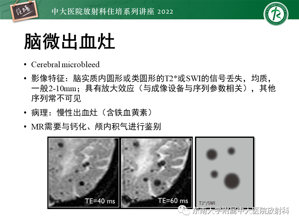 【PPT】脑小血管病概念、影像维度及其深度学习进展-11