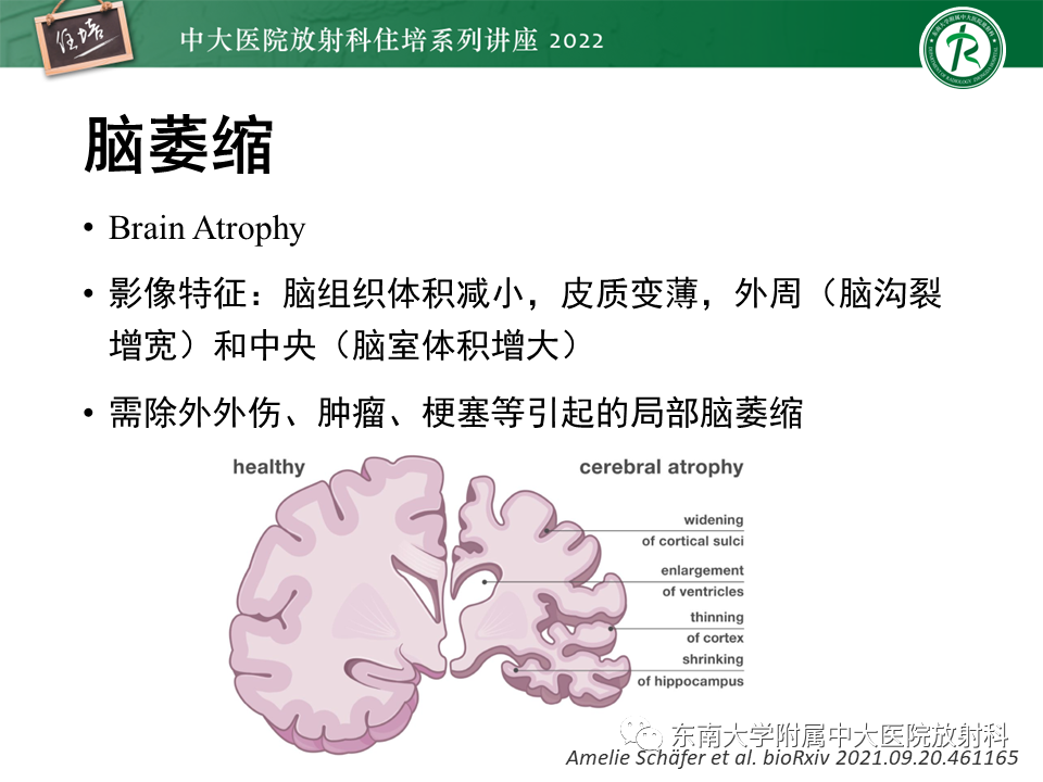 【PPT】脑小血管病概念、影像维度及其深度学习进展-12