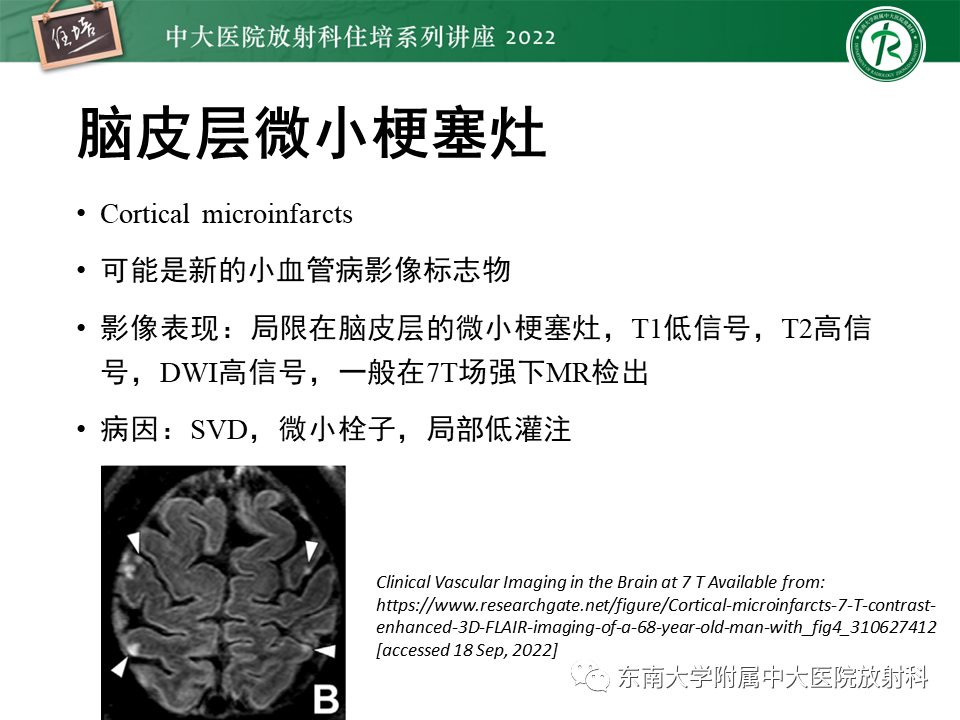 【PPT】脑小血管病概念、影像维度及其深度学习进展-14