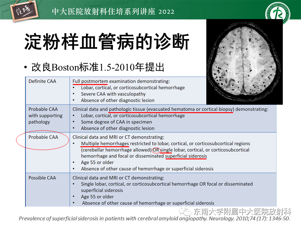 【PPT】脑小血管病概念、影像维度及其深度学习进展-15