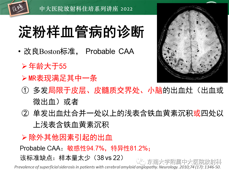 【PPT】脑小血管病概念、影像维度及其深度学习进展-16