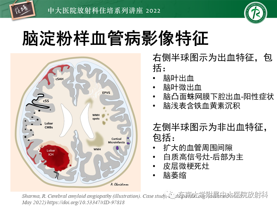 【PPT】脑小血管病概念、影像维度及其深度学习进展-18