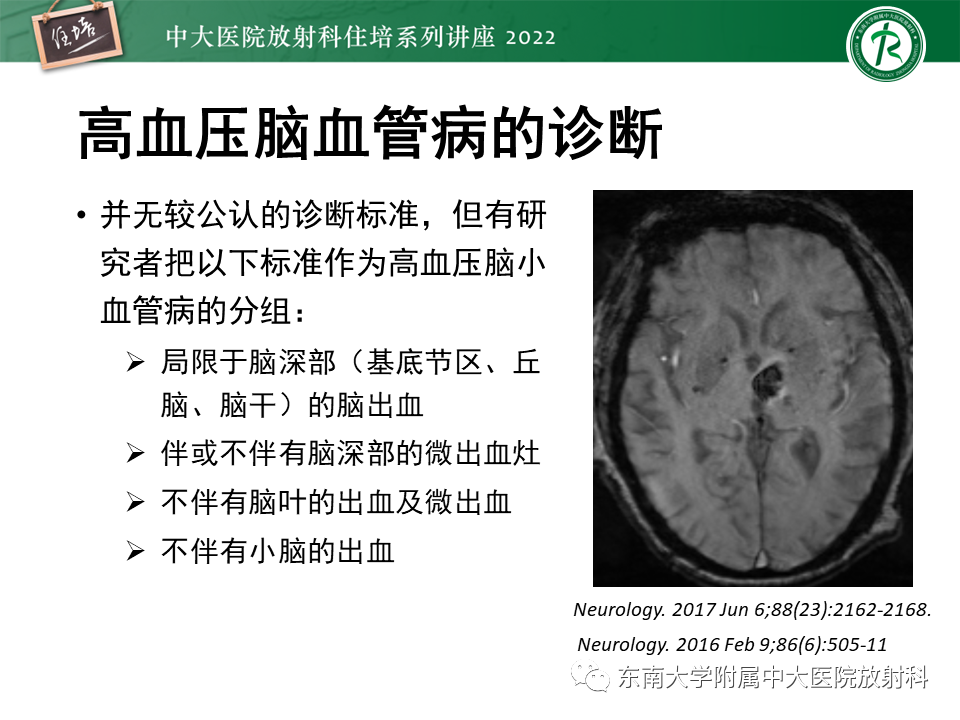 【PPT】脑小血管病概念、影像维度及其深度学习进展-20
