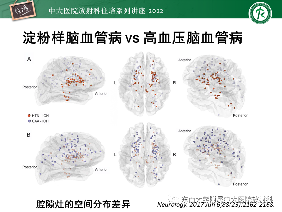 【PPT】脑小血管病概念、影像维度及其深度学习进展-23