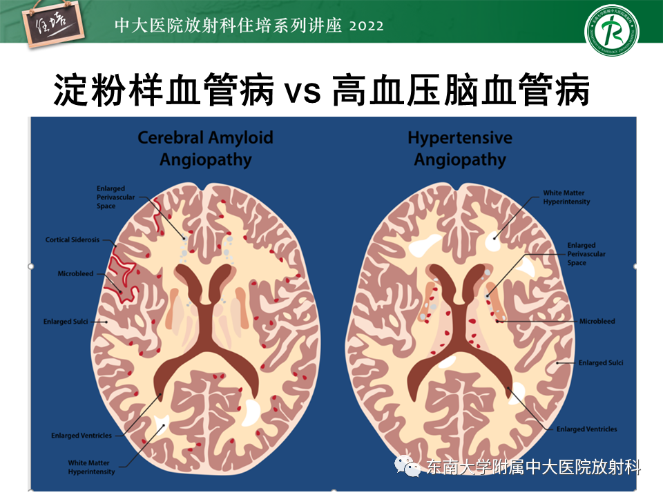 【PPT】脑小血管病概念、影像维度及其深度学习进展-22