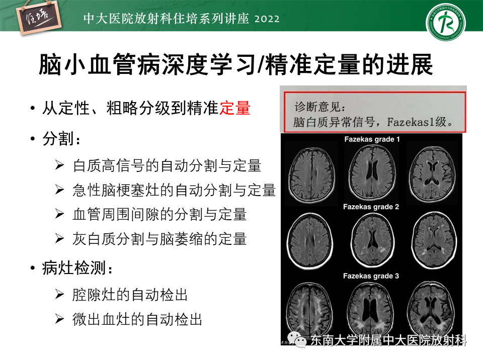 【PPT】脑小血管病概念、影像维度及其深度学习进展-24