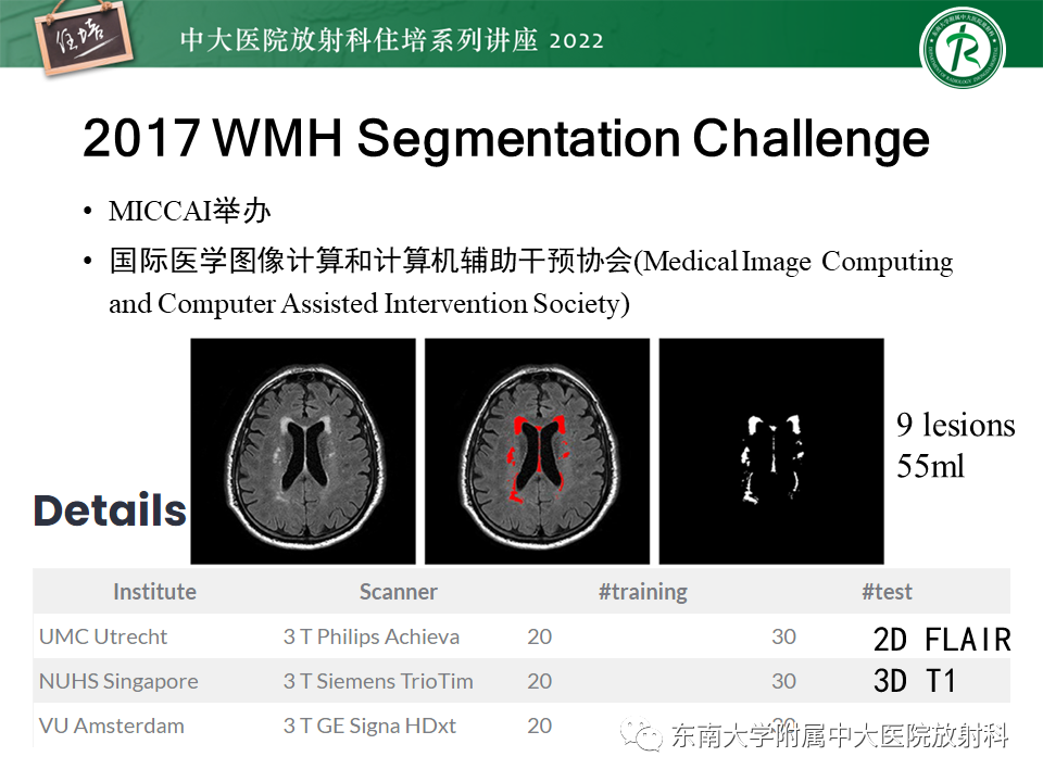 【PPT】脑小血管病概念、影像维度及其深度学习进展-25