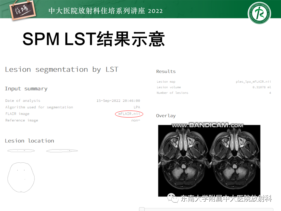 【PPT】脑小血管病概念、影像维度及其深度学习进展-28