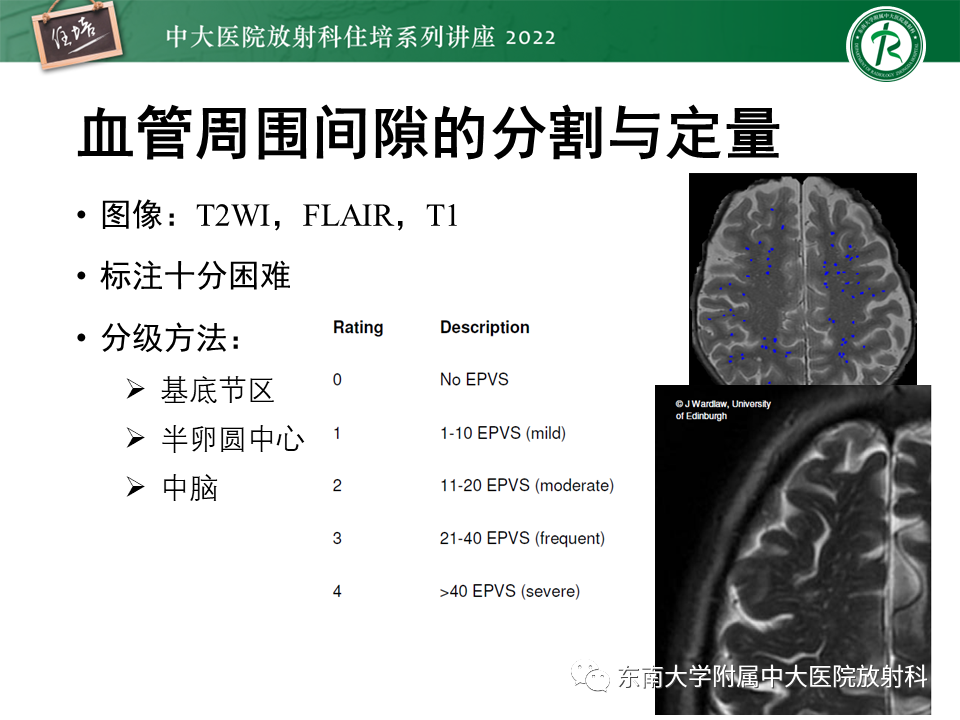 【PPT】脑小血管病概念、影像维度及其深度学习进展-30