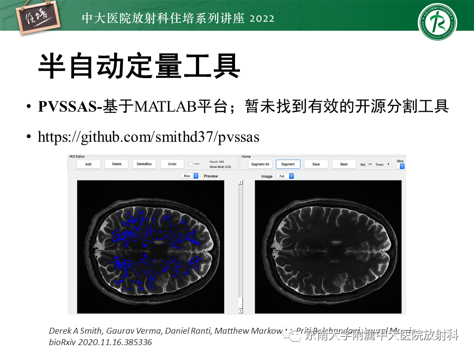 【PPT】脑小血管病概念、影像维度及其深度学习进展-31