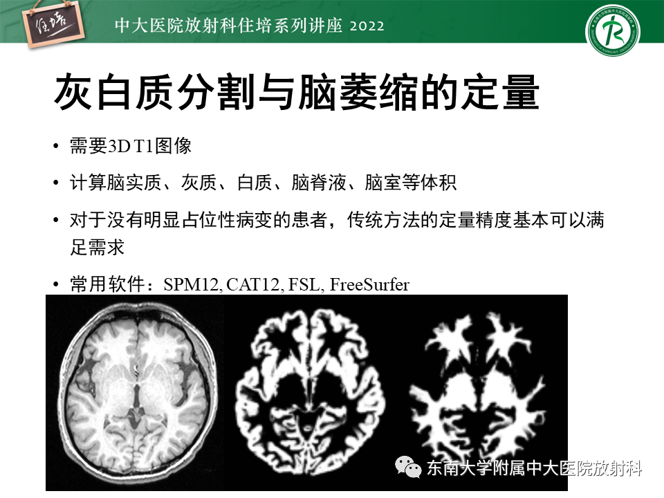 【PPT】脑小血管病概念、影像维度及其深度学习进展-33