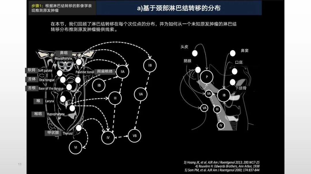 【PPT】原发肿瘤在哪里？不明原发肿瘤颈部淋巴结转移的影像学检查方法-11