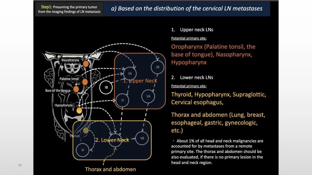 【PPT】原发肿瘤在哪里？不明原发肿瘤颈部淋巴结转移的影像学检查方法-30