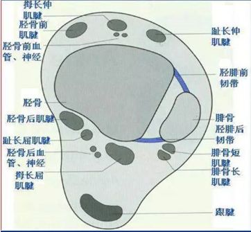 踝关节MRI解剖及7种常见损伤类型影像表现-18