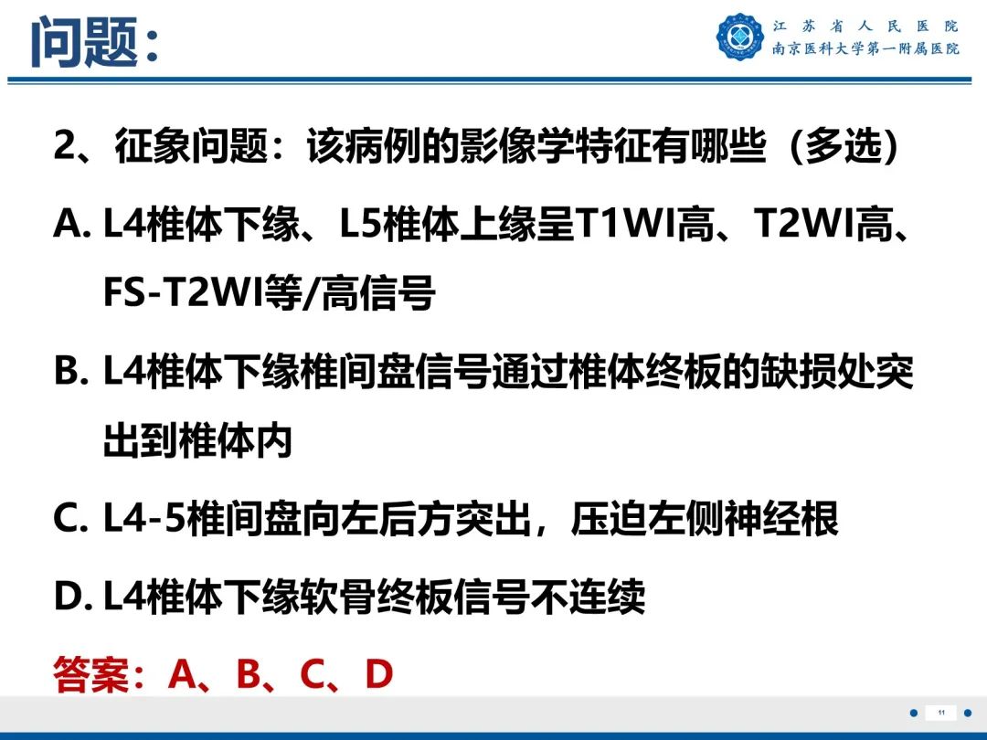 【PPT】终板炎-12