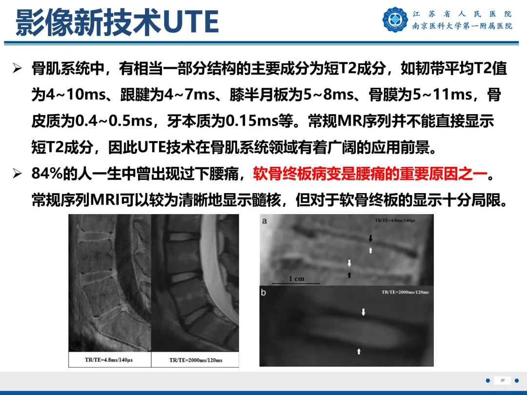 【PPT】终板炎-28