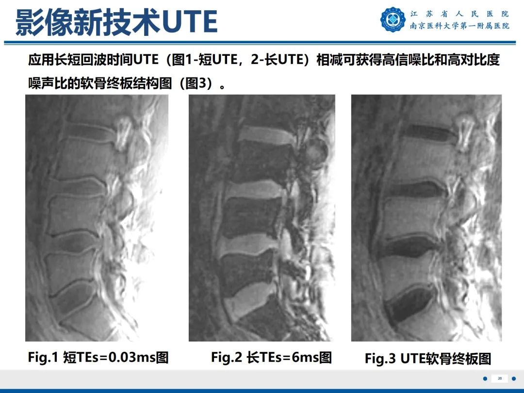 【PPT】终板炎-29