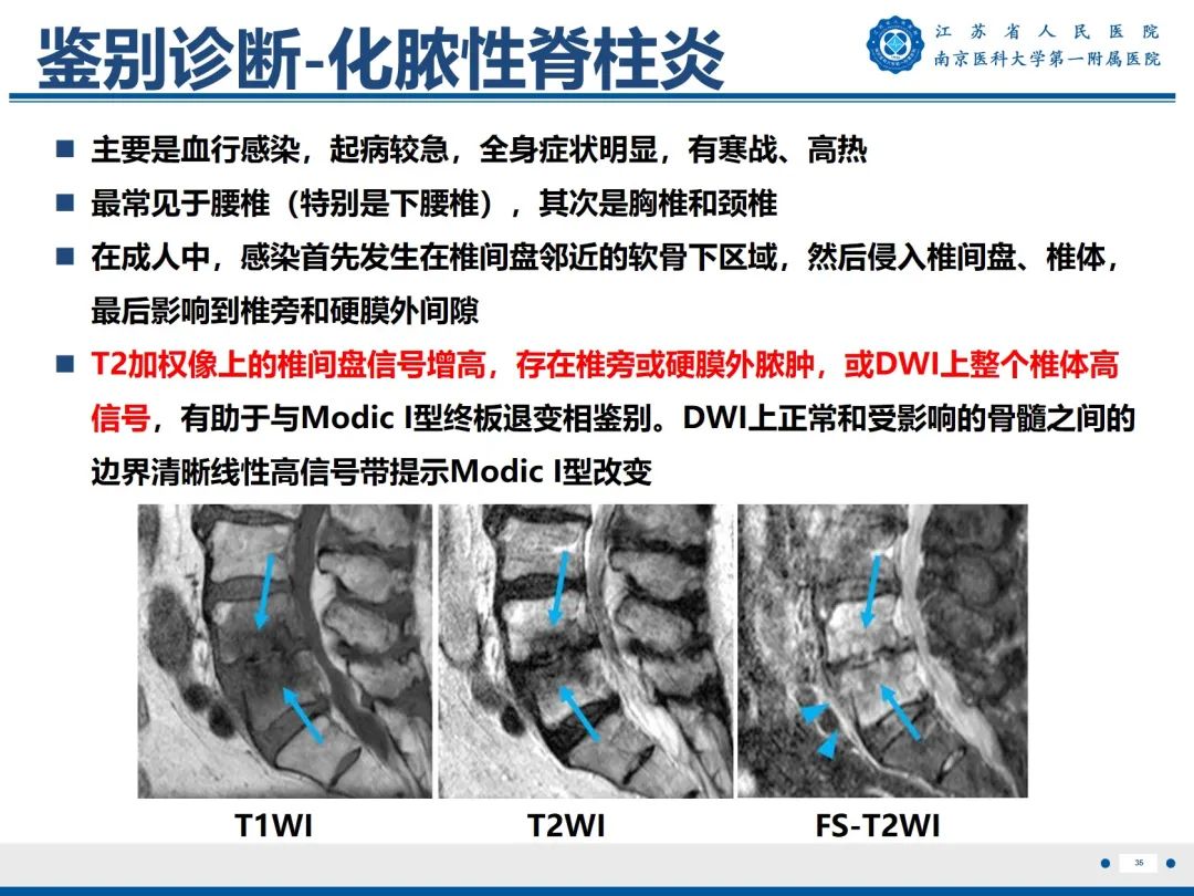 【PPT】终板炎-36