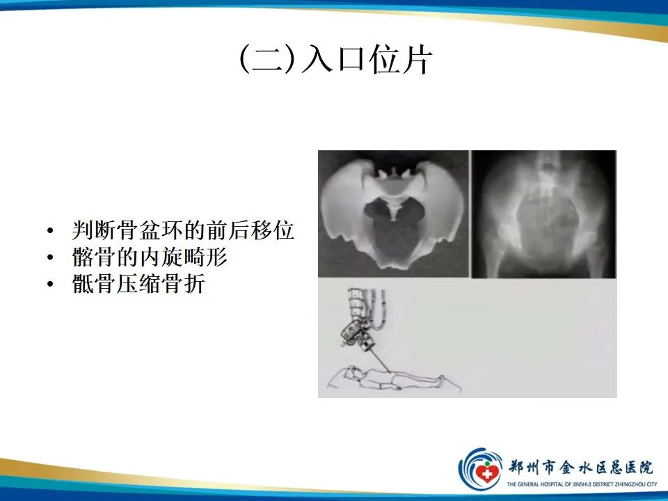 【PPT】骨盆拍片技术与临床意义-10